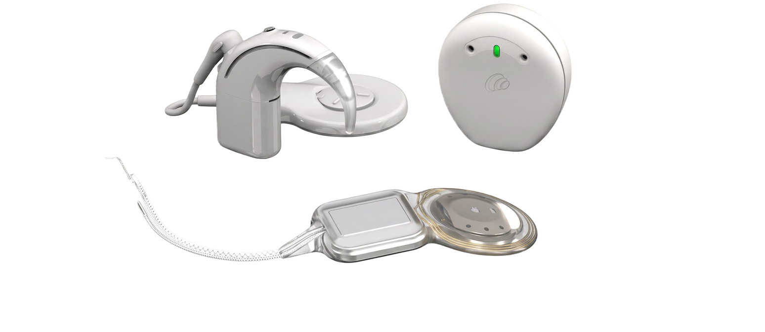 Cochlear Nucleus Nexa beszédprocesszor